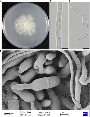 A New Species in Pseudophialophora From Wild Rice and Beneficial Potential